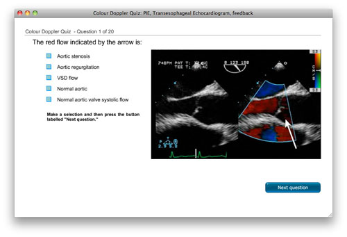 Colour doppler quiz image