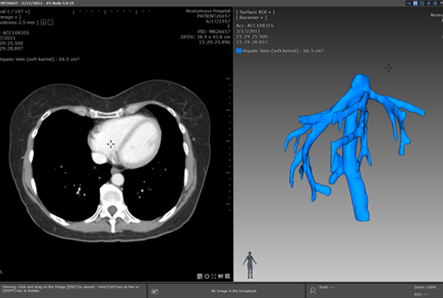 ct scan