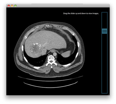 CT/MRI Viewer